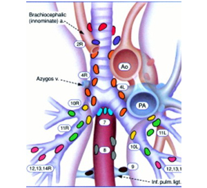 mediastinal